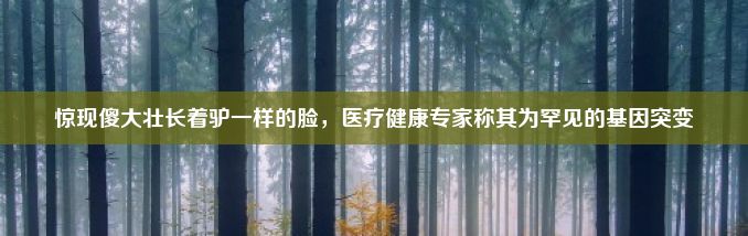 惊现傻大壮长着驴一样的脸，医疗健康专家称其为罕见的基因突变